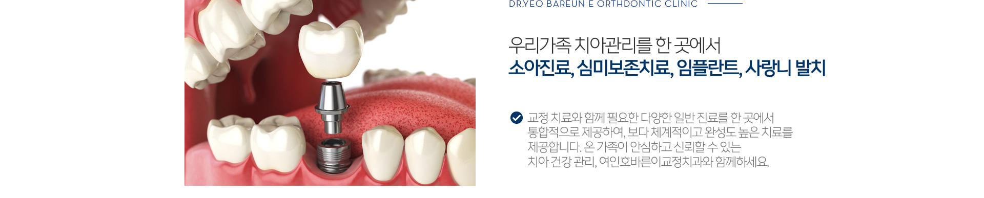 우리가족 치아관리를 한 곳에서 소아진료, 심미보존치료, 임플란트, 사랑니 발치